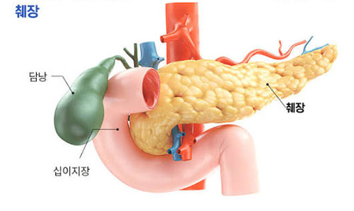 췌장암이 무서운 진짜 이유, 아파서 병원 가면 늦다 - Irving - 1