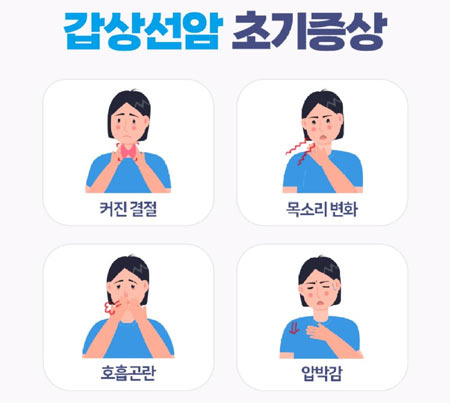 갑상선암, 많이 들어봤지만 의외로 잘 몰랐던 사실들 - Burke - 1