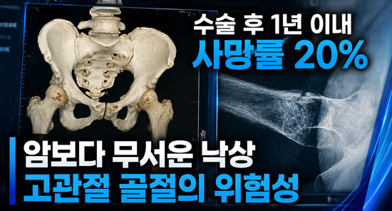 미국 노인들이 워커를 괜히 쓰는 게 아니다, 고관절 지키는 방법 - Morgantown - 1