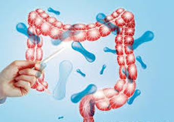 Symptoms and Diseases of Gut Flora (Probiotics) Deficiency - San Jose - 1