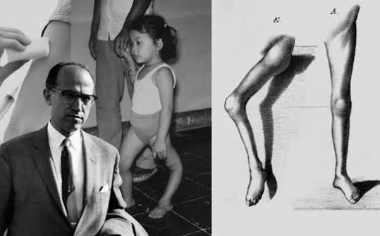 소아마비의 영어 이름은 Polio, 백신으로 사라진 질병 - San Diego - 1