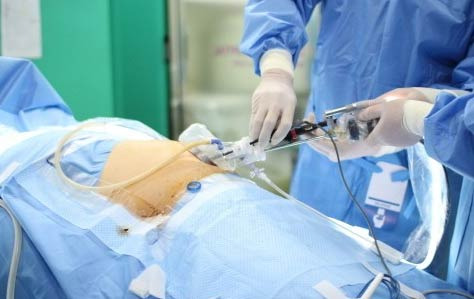 미국에서 맹장 터지면 병원비 얼마 나올까? 수술비의 현실 - Tampa - 1