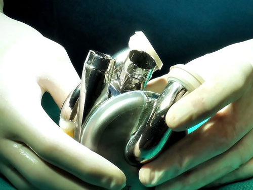 People Surviving with New Technology Artificial Hearts Without Heartbeats - San Jose - 4
