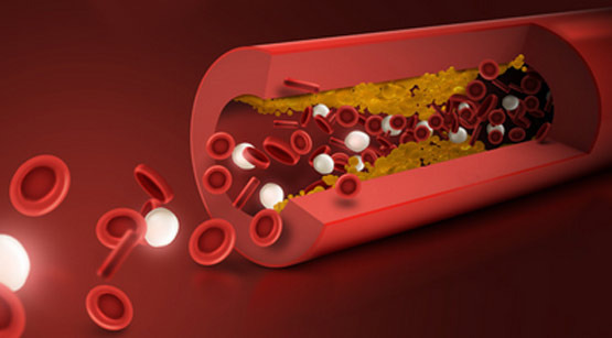 Causes and Symptoms of Diabetes That Can Reduce Average Lifespan by at Least 8 Years - Tacoma - 1