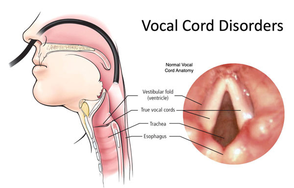 Why Does Our Voice Lose Strength as We Age? The Vocal Cords Also Age - Las Vegas - 1
