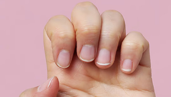 Hair and Nails as Indicators of Our Health - Los Angeles - 1