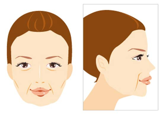 The Reason Why Cheeks Sag and Nasolabial Folds Deepen After Turning Forty - Memphis - 1