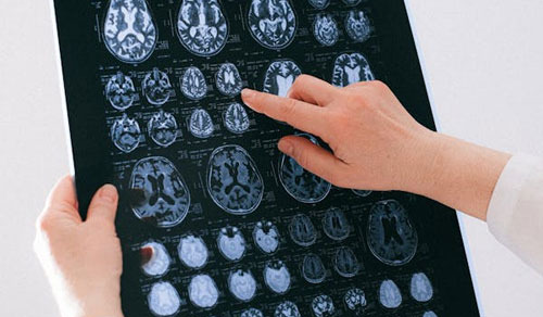 How to Maintain Brain Health in Immigrant Life - Dallas - 1