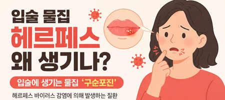 단순포진 바이러스 헤르페스, 결국 면역력 싸움이다 - Honolulu - 2